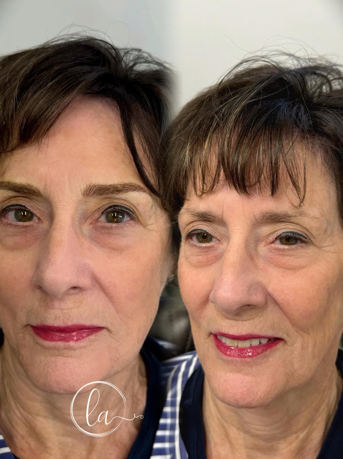 Antes y después cejas — LA Studio Brows Beauty